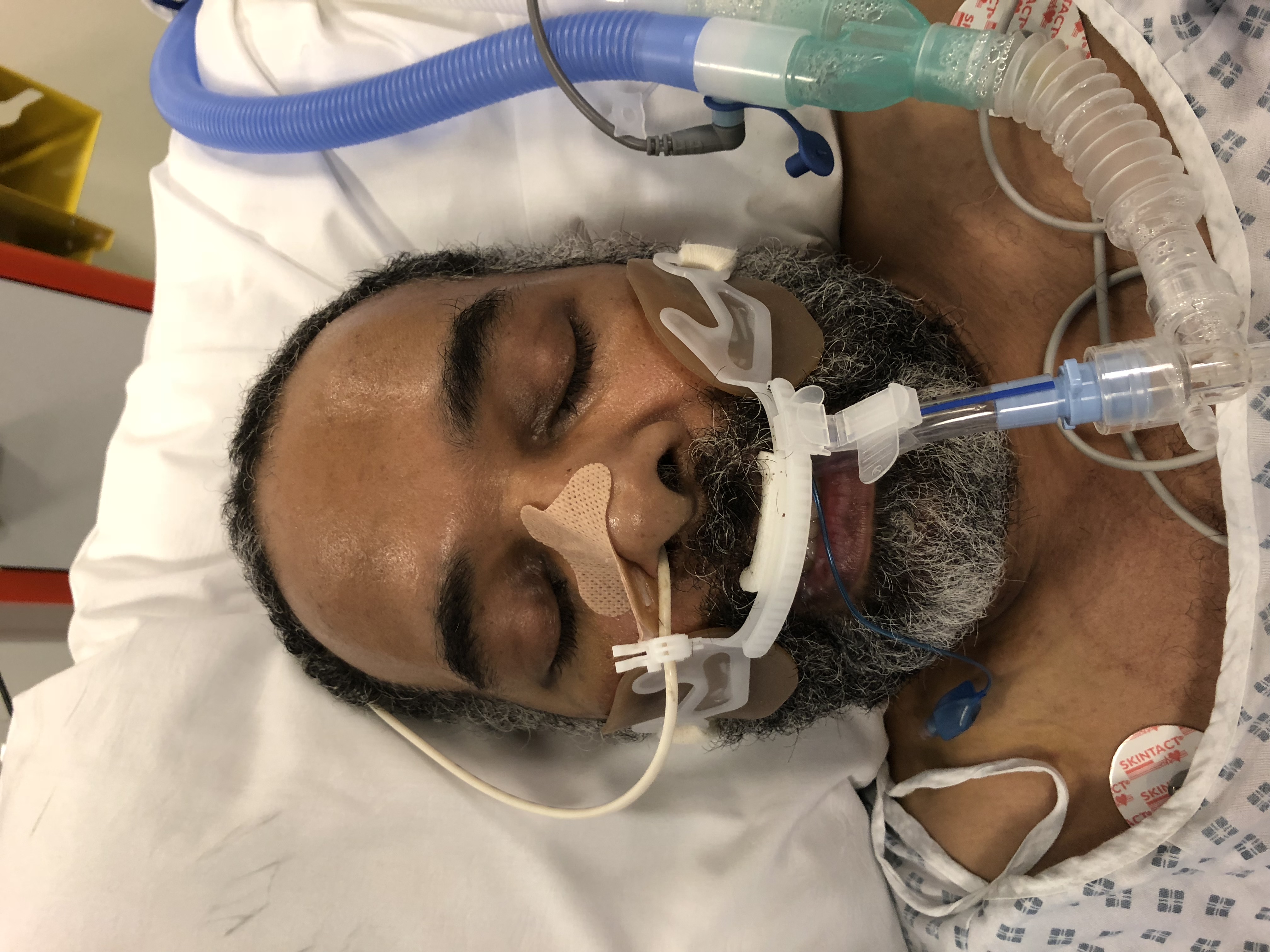 Mystery man in coma still unidentified three weeks after collapsing outside hospital mystery man uclh january 2018